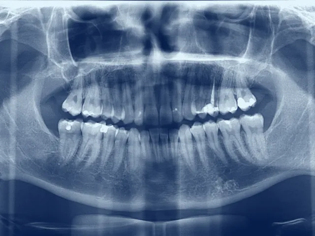 Una radiografia panoramica delle arcate dentarie, virata in blu