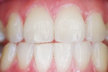 Gli incisivi di un sorriso, da vicino